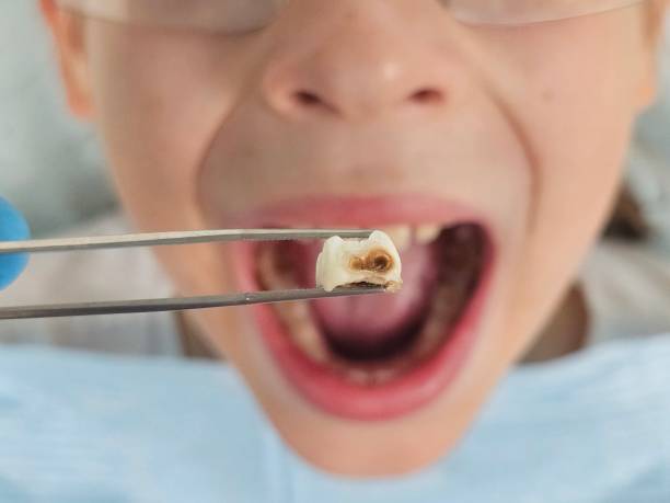 Best Emergency Gum Treatment in USA